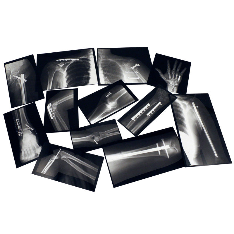 ROYLCO - Fixed Bones X-Ray Set