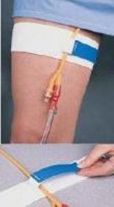 Bird & Cronin - Leg Stap Cath-Mate® II Stretches to fit Up to 26 Inch Thigh, Hook and Loop Closure [1/EA]