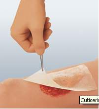 Smith & Nephew - Oil Emulsion Impregnated Dressing Cuticerin Rectangle 3 X 8 Inch Sterile [300/CS]